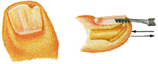 558b2f9d-88bd-4e6e-a705-4da545af4998