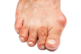 foot-pain