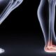 Ankle Pain Treatment