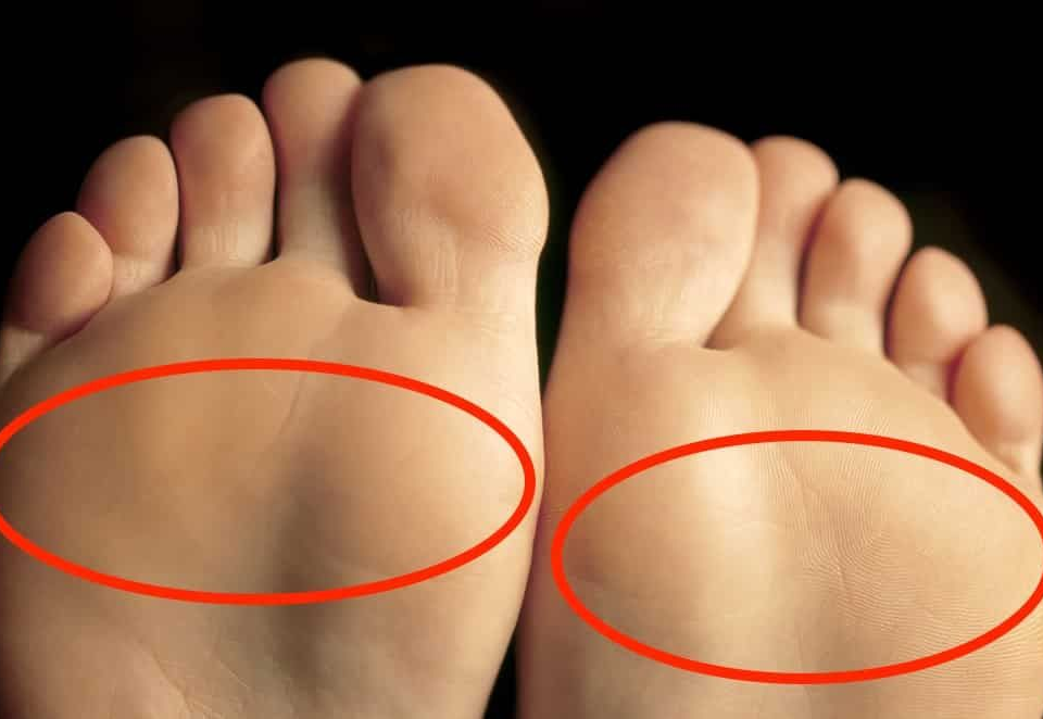 What causes pain in the ball of the foot