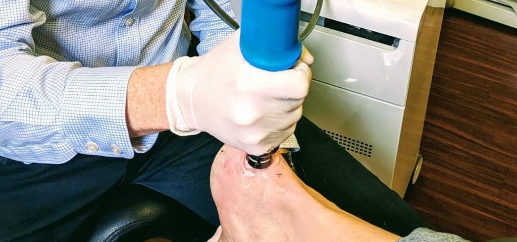 Shockwave Therapy for Relieving Foot and Heel Pain
