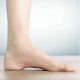 plantar fasciitis