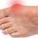 Banishing Bunion Pain