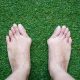 Bunion Surgery