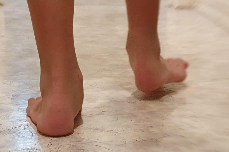 Flat Feet in Kids